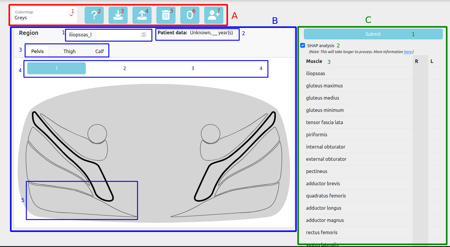 Diagnosis tool layout